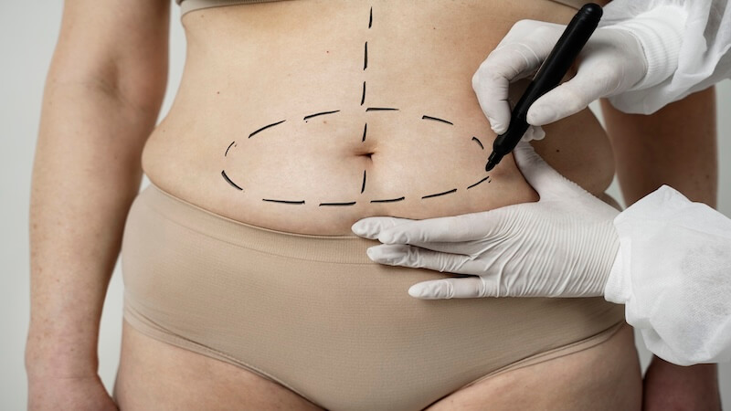 Op. Dr. Gökhan Semerci ile Karın Germe (Abdominoplasti) Uzmanlığı